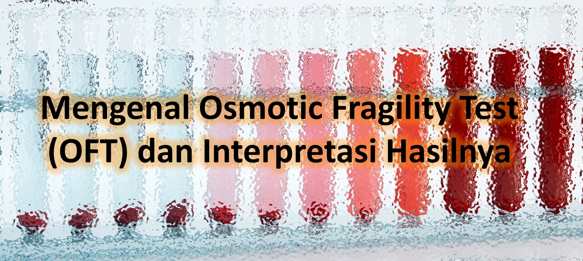 Mengenal Osmotic Fragility Test (OFT) dan Interpretasi Hasilnya