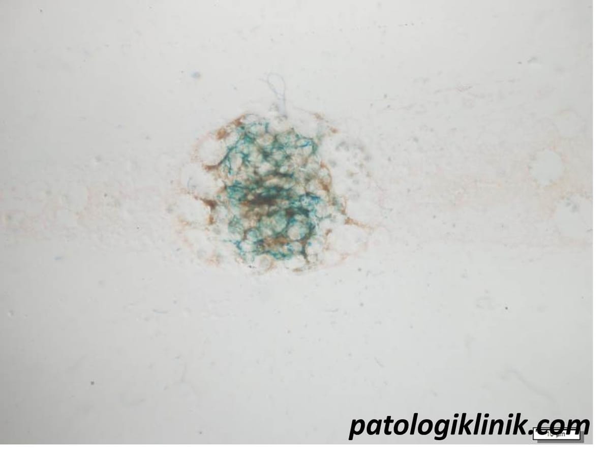 Metode Pengecatan Hemosiderin (Prussian-blue)