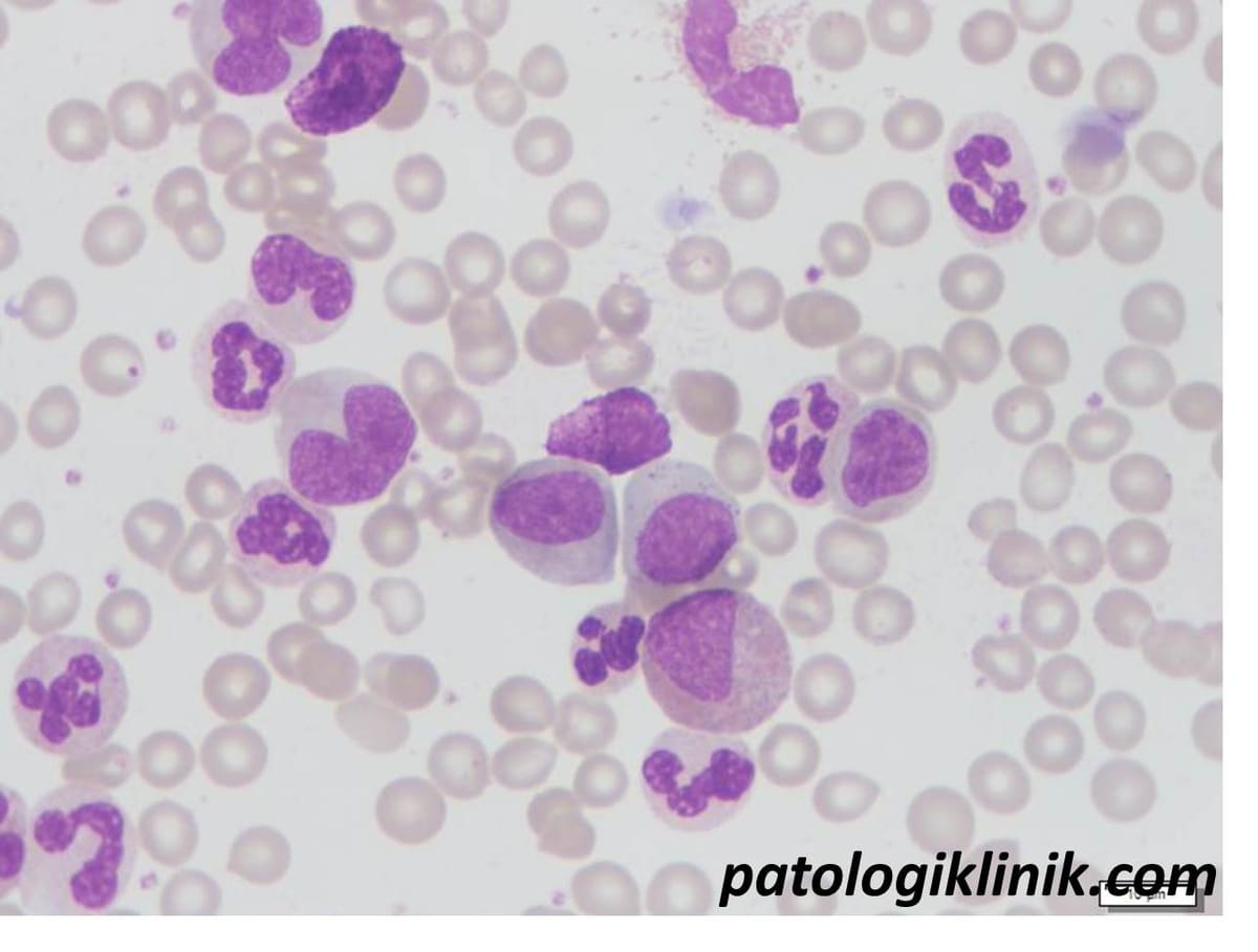 Pemeriksaan I/T Ratio