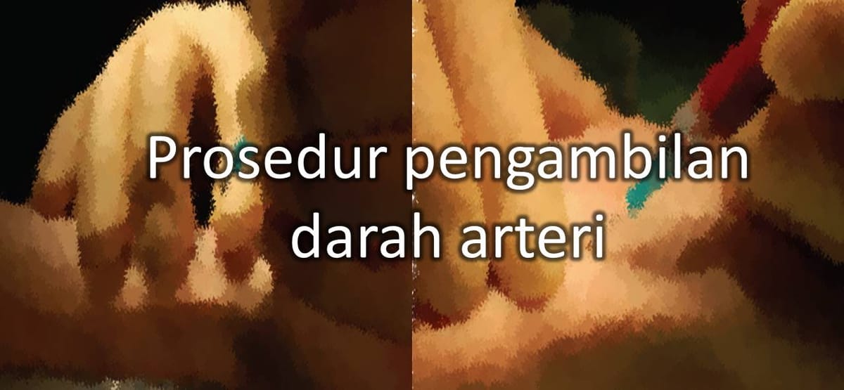 Prosedur Pengambilan Darah Arteri