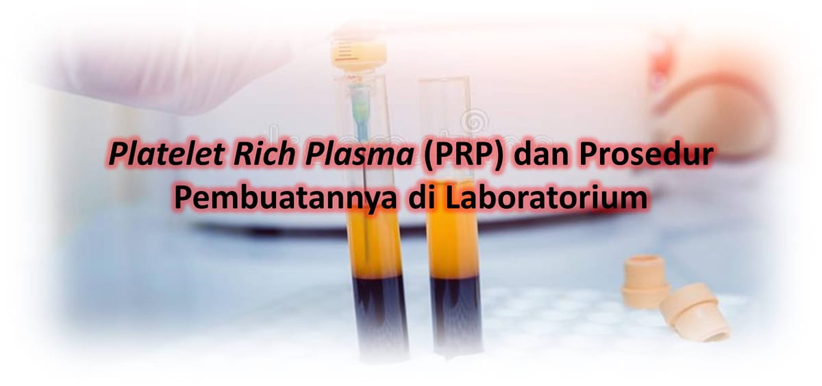 Platelet Rich Plasma (PRP) dan Prosedur Pembuatannya di Laboratorium