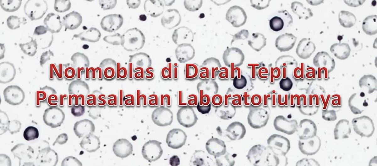 Normoblas di Darah Tepi dan Permasalahan Laboratoriumnya