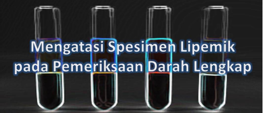 Mengatasi Spesimen Lipemik pada Pemeriksaan Darah Lengkap