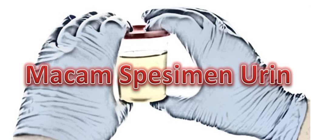 Macam Spesimen Urin