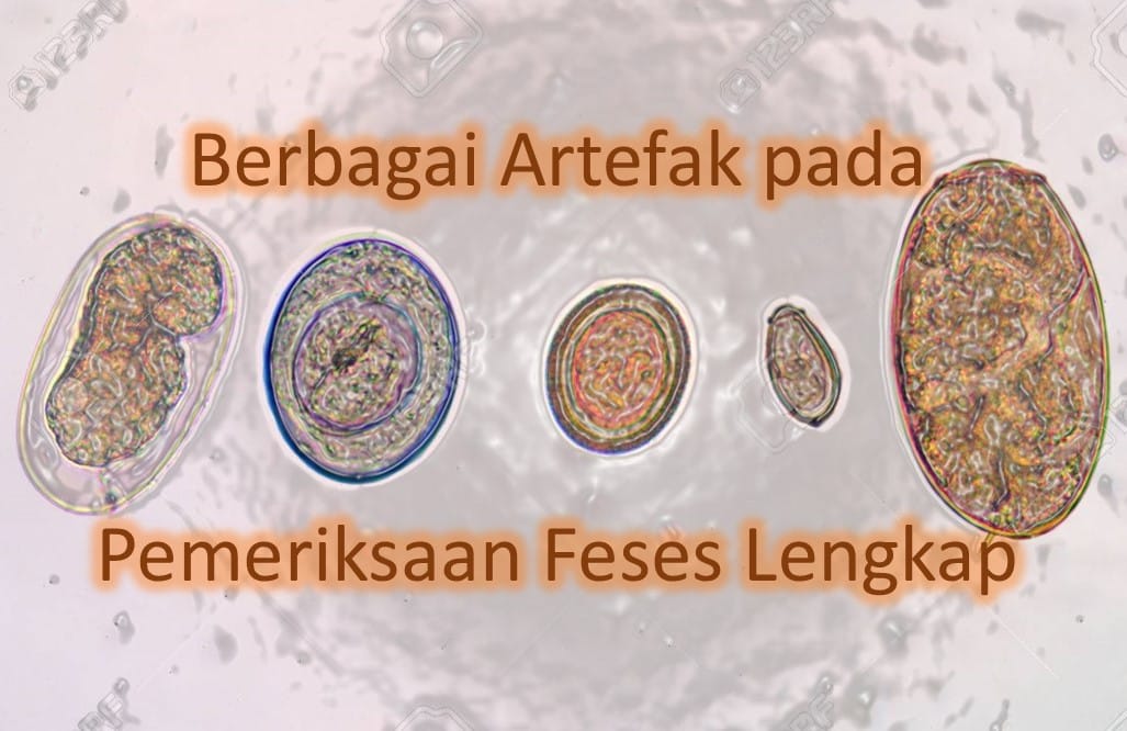 Berbagai Artefak pada Pemeriksaan Feses Lengkap