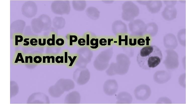 Pseudo Pelger-Huet Anomaly