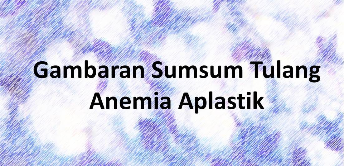 Gambaran Sumsum Tulang Anemia Aplastik