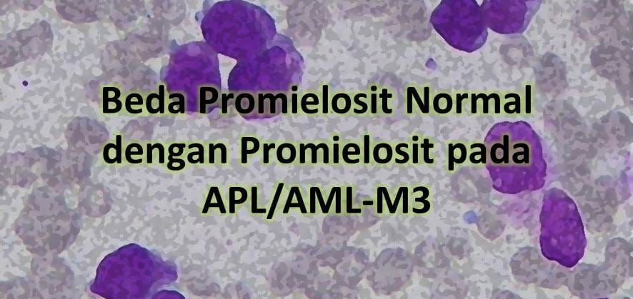 Beda Promielosit Normal dengan Promielosit pada APL/AML-M3