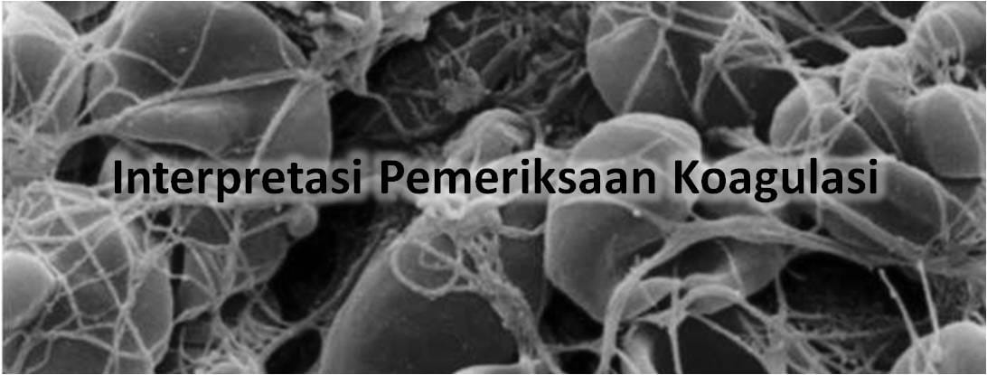 Interpretasi Pemeriksaan Koagulasi
