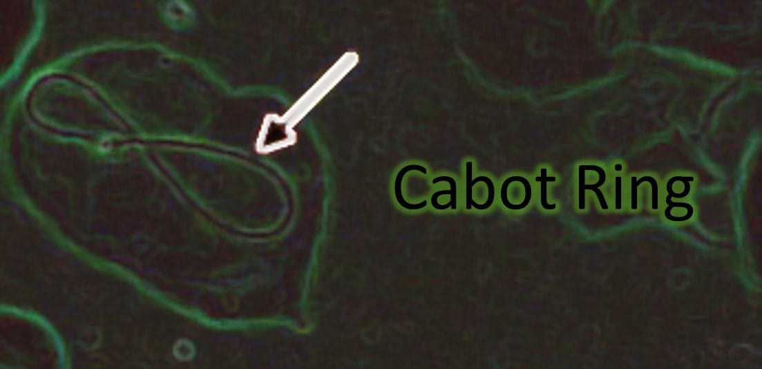 Cabot Ring
