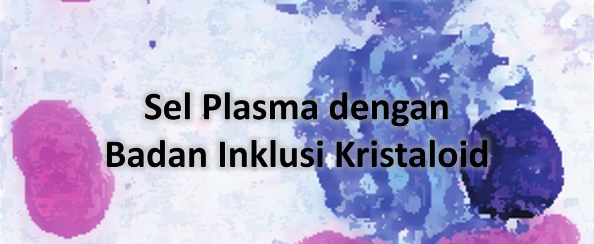 Sel Plasma dengan Badan Inklusi Kristaloid