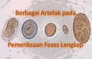 arbre genealogique - Kesimpulan