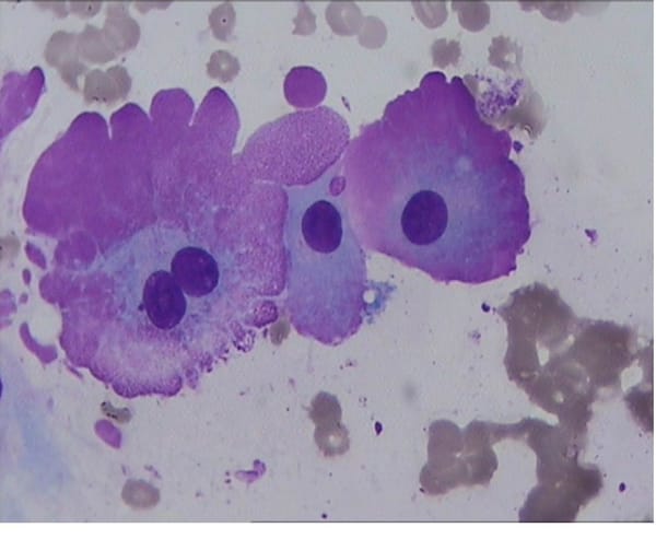 Fire Cells Microscope Flame cell