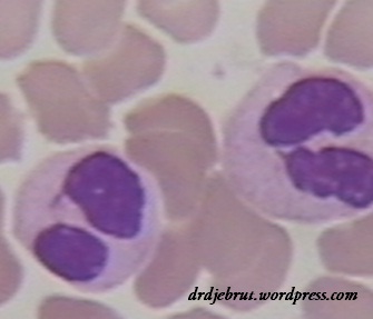 kelainan Pelger Huet