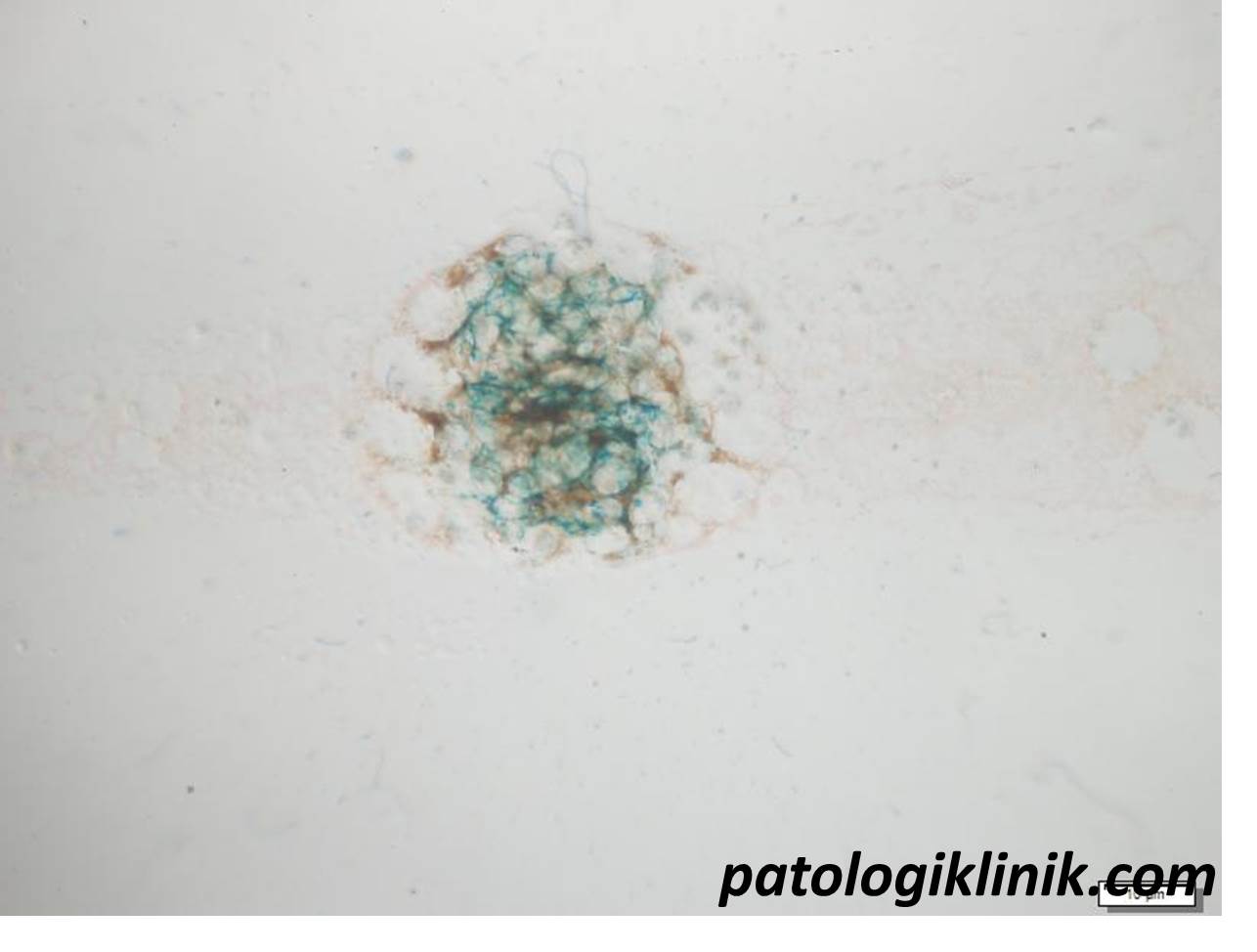 Metode Pengecatan Hemosiderin (Prussian-blue)