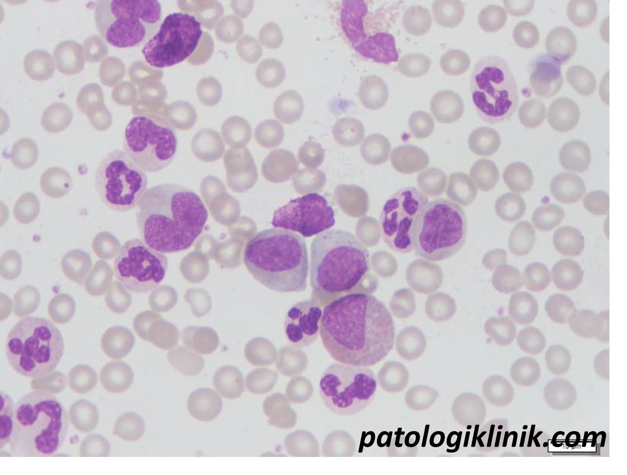 Pemeriksaan I/T Ratio