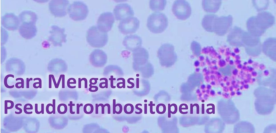 Cara Mengatasi Trombositopenia Palsu (Pseudotrombositopenia)