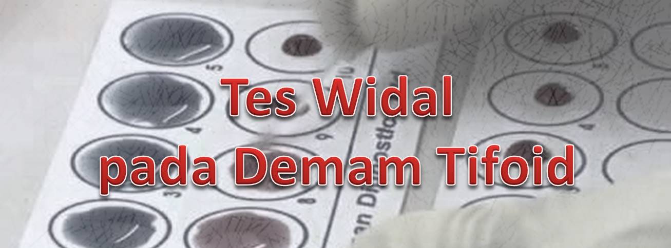 Penggunaan Tes Widal pada Diagnosis Demam Tifoid