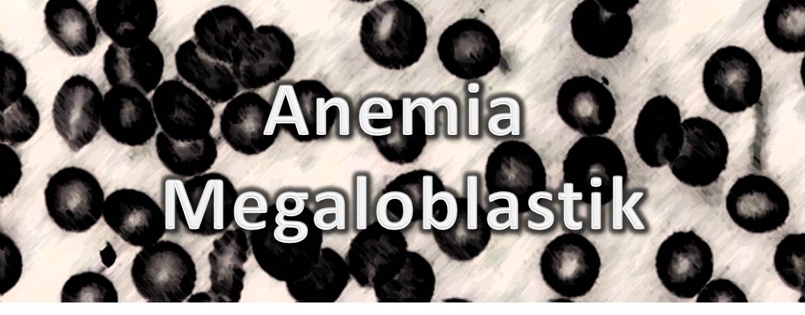 Anemia Megaloblastik