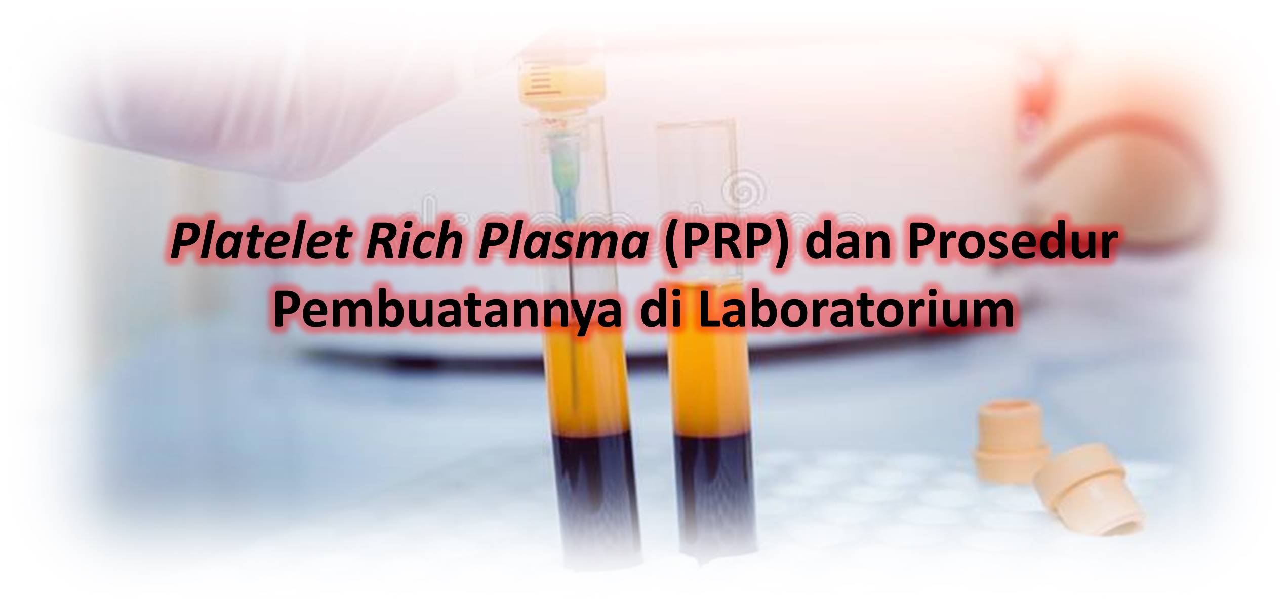 Platelet Rich Plasma (PRP) dan Prosedur Pembuatannya di Laboratorium