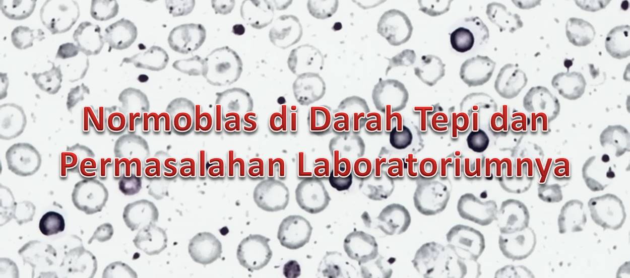 Normoblas di Darah Tepi dan Permasalahan Laboratoriumnya