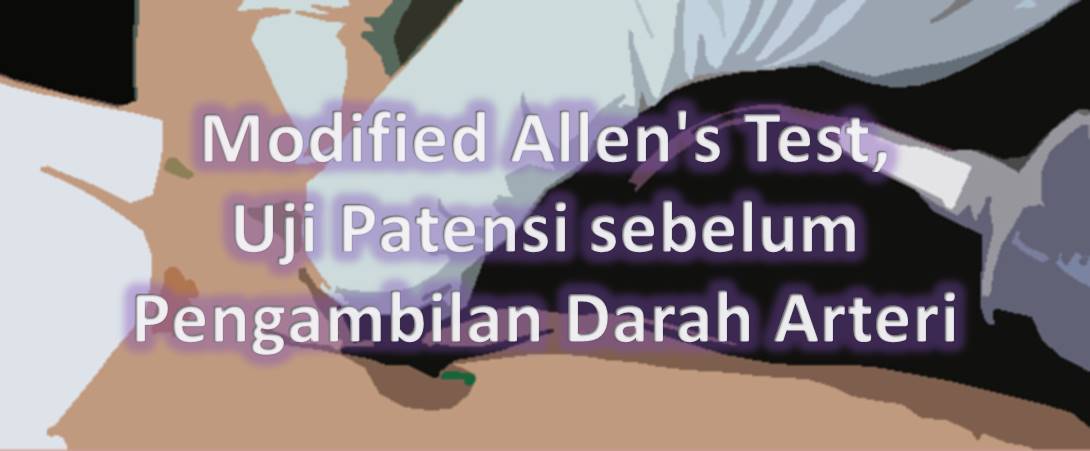 Modified Allen's Test, Uji Patensi sebelum Pengambilan Darah Arteri