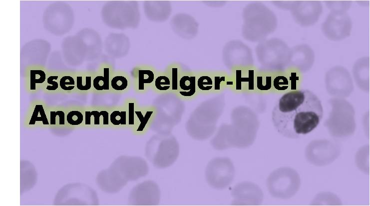 Pseudo Pelger-Huet Anomaly