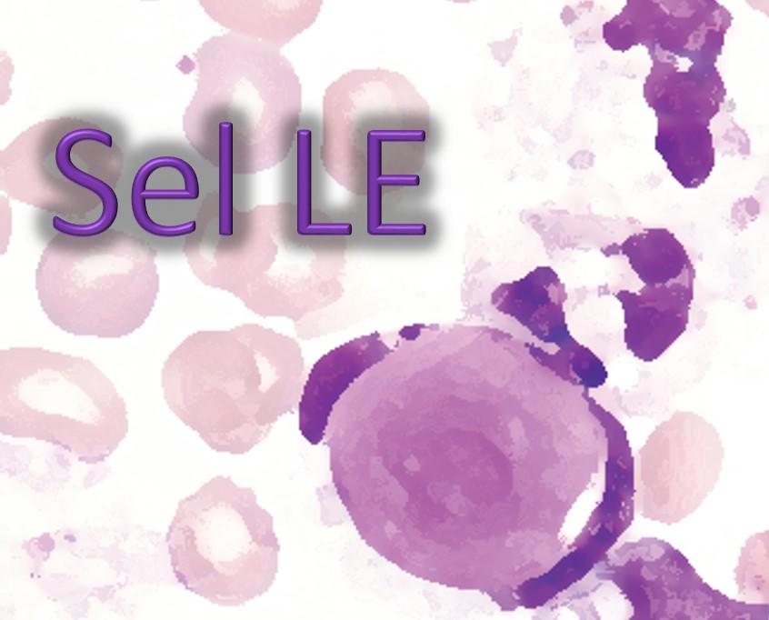 Sel Lupus Erythematosus (Sel LE)