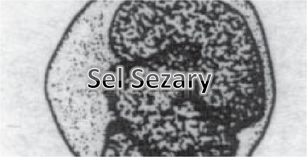 Sel Sezary