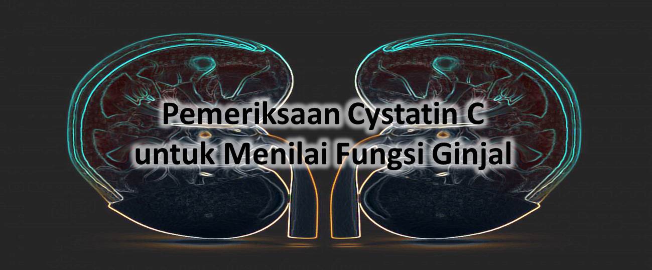 Pemeriksaan Cystatin C untuk Menilai Fungsi Ginjal