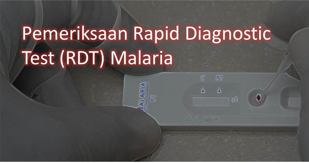 Pemeriksaan Rapid Diagnostic Test (RDT) Malaria