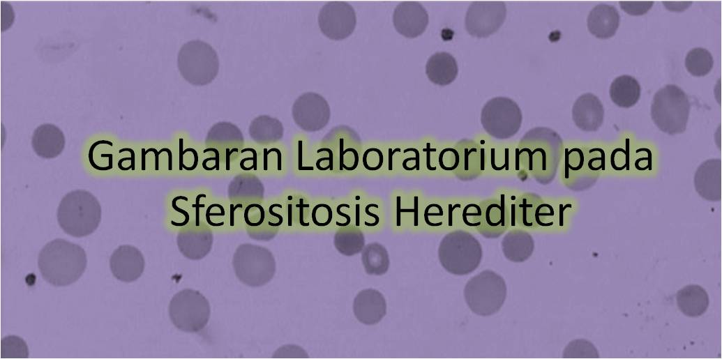 Gambaran Laboratorium pada Sferositosis Herediter
