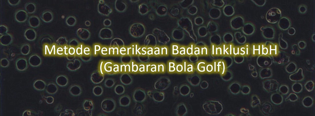 Metode Pemeriksaan Badan Inklusi HbH (Gambaran Bola Golf)