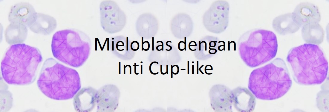 Mieloblas dengan Inti Cup-like