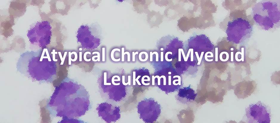 Atypical Chronic Myeloid Leukemia (aCML)