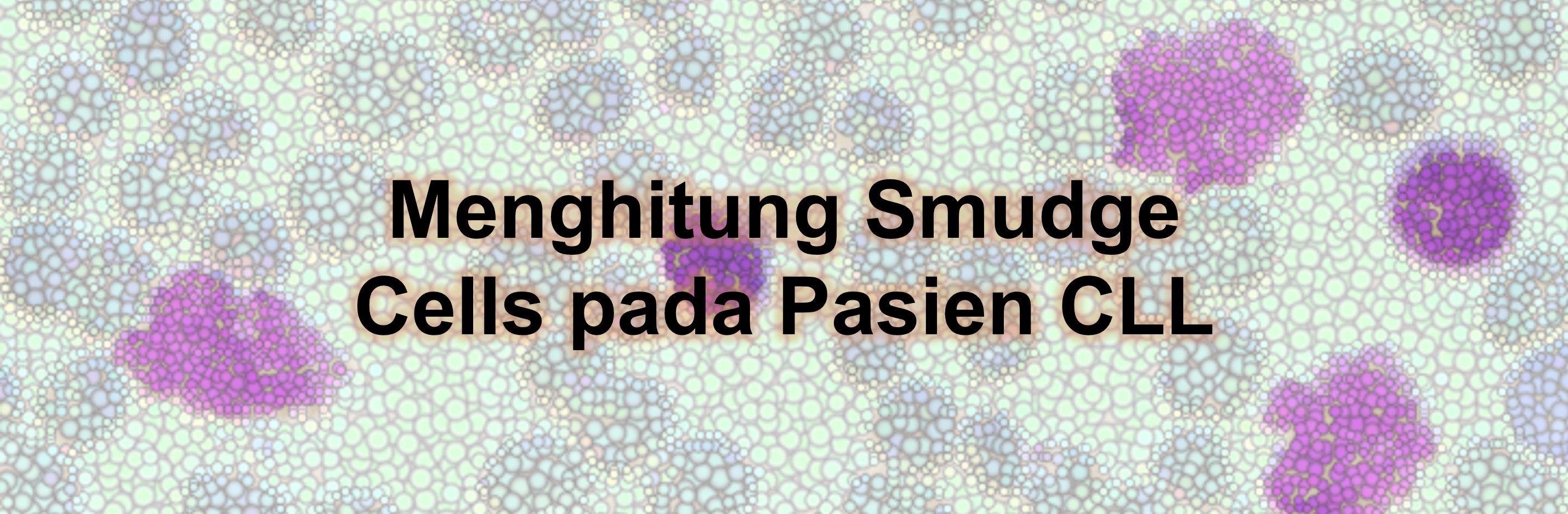 Menghitung Smudge Cells pada Pasien CLL